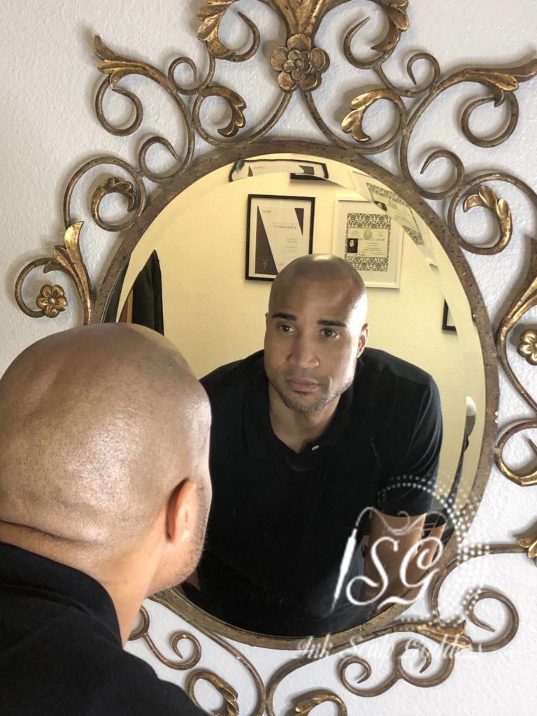 SCALP MICROPIGMENTATION MEN