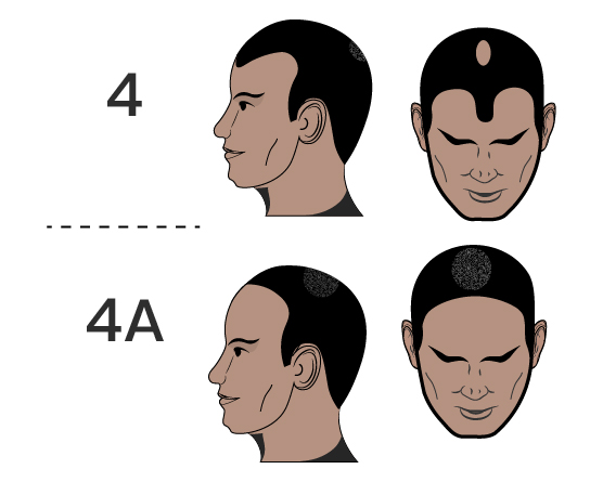 man faces(5)
