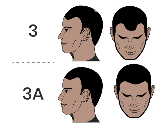 man faces(1)