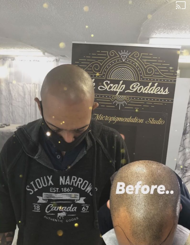 Bald Man(5)