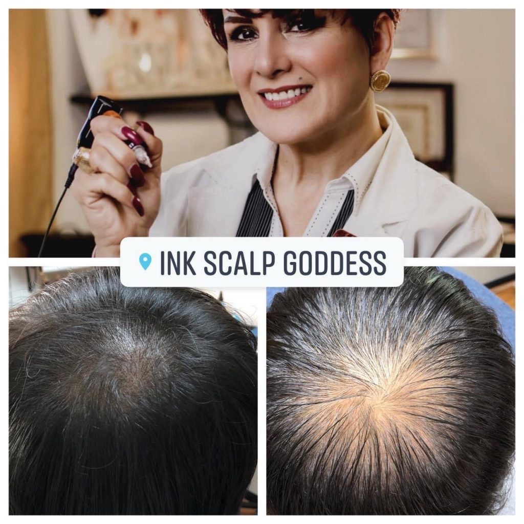 Scalp(4)