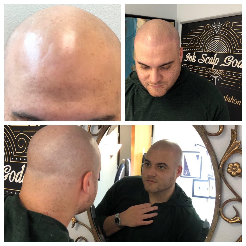 Bald Man